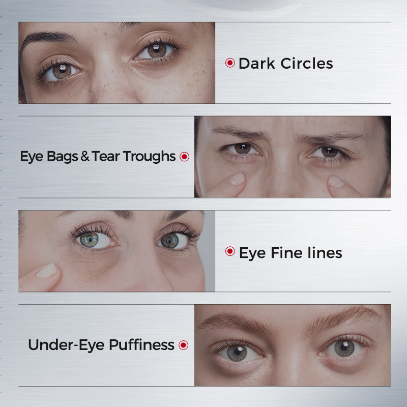 Parches para Ojos para Ojeras  - Collagen Under Eye Patches reseña y precio