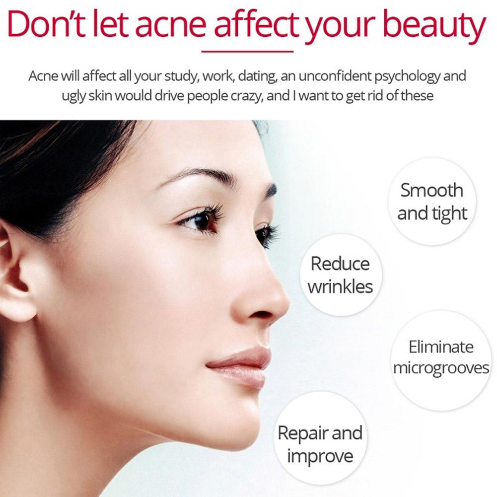 Crema reafirmante Lifting de R - Retinol Anti Wrinkle Cream reseña y precio