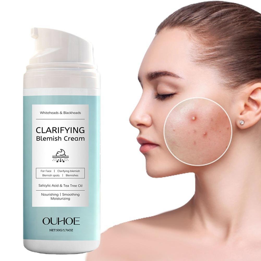 Crema para Eliminar el Acné co - Salicylic Acid Blackhead Remover reseña y precio
