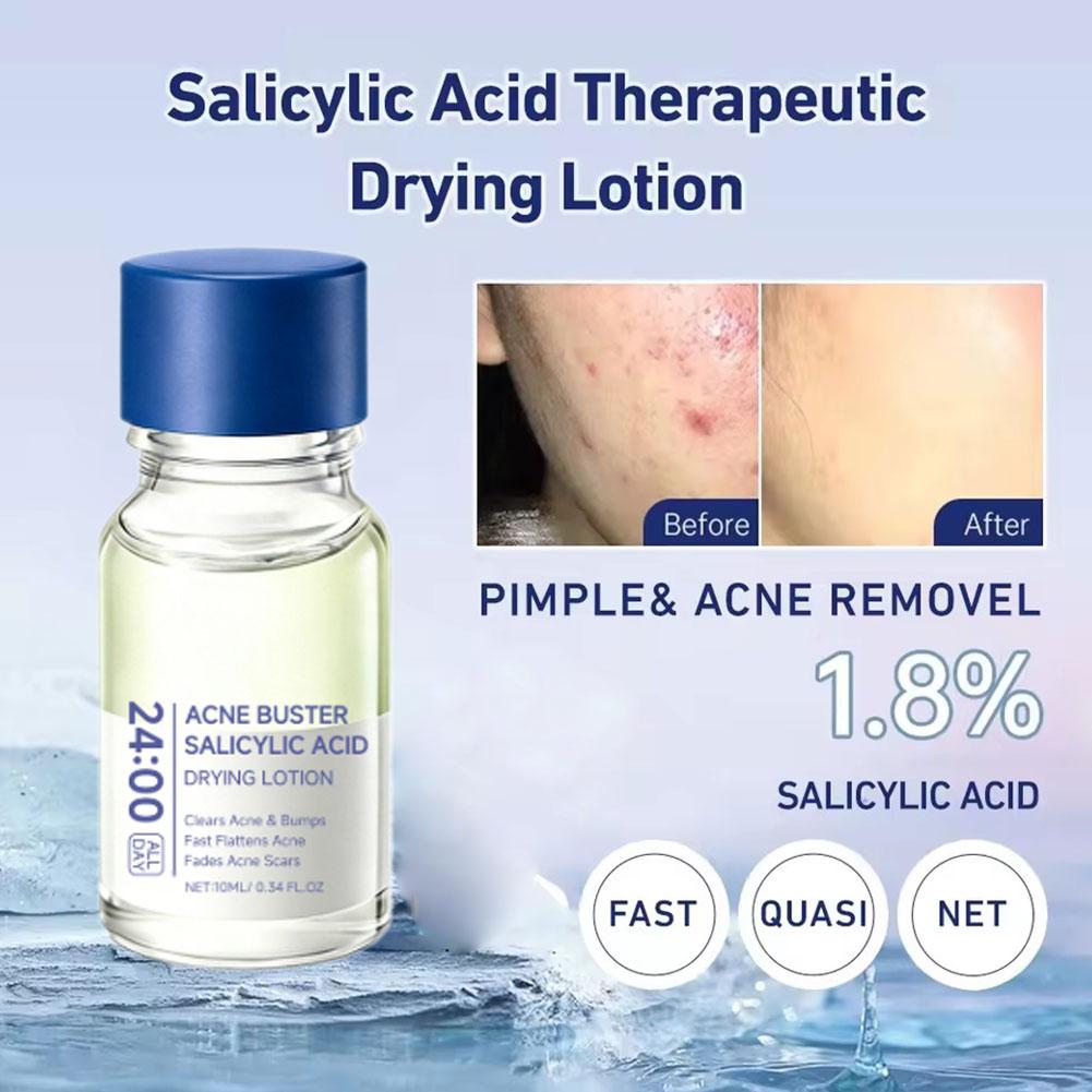 Ácido Salicílico Eliminador de - Salicylic Acid Blackhead Remover reseña y precio